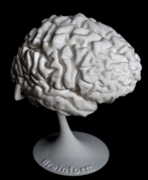 3D-печать головного мозга - медицинский и познавательный аспект